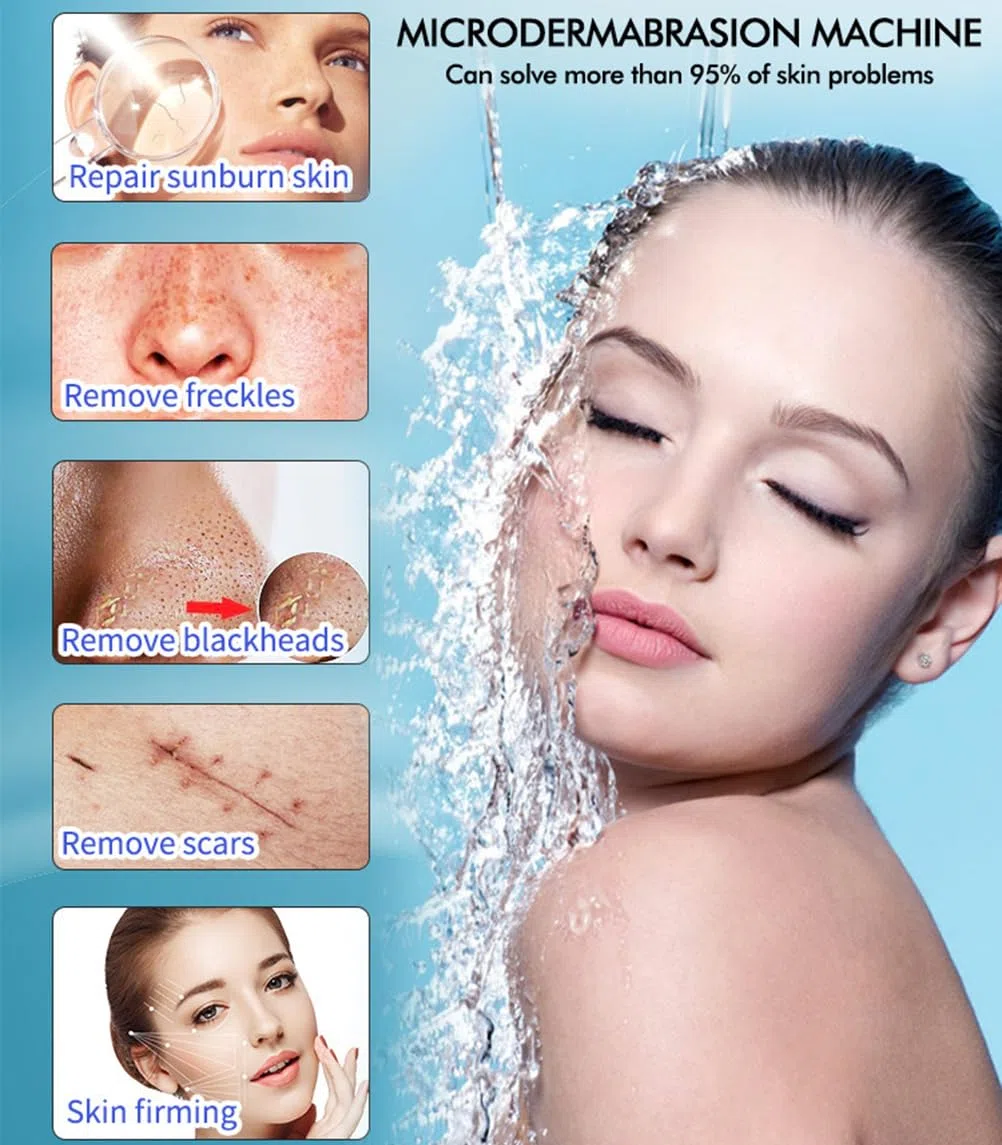 Dispositivo de RF fraccional de hidrodermoabrasión de limpieza con depurador de estiramiento facial Bio RF Rejuvenecimiento de la piel Blanqueamiento Equipo,Blanco