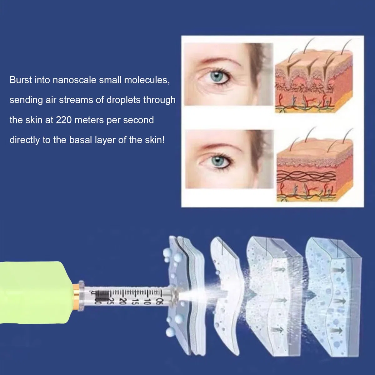 Pluma de inyección hialurónica automática, pluma inyectora facial para eliminación de lipólisis de arrugas, máquina de cuidado facial para apretar la piel (verde)