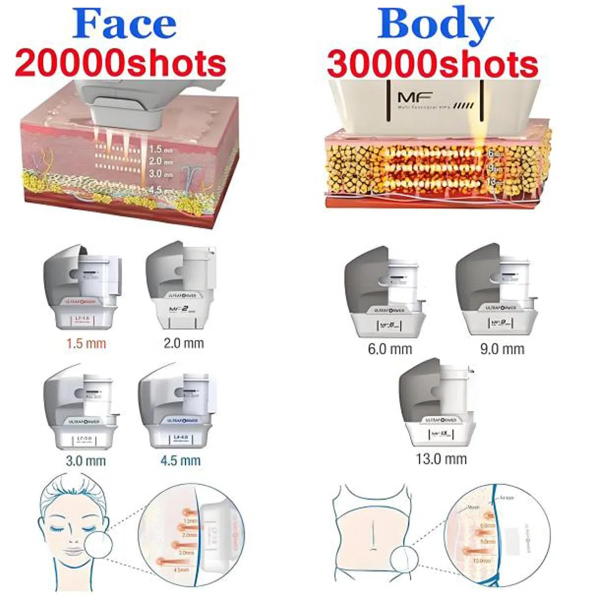 Máquina Profesional para reafirmar la Piel del Rostro, Antiarrugas, Adelgazante y antienvejecimiento, con 7 Cartuchos,para Eliminar Arrugas Faciales,Seguro E Indoloro para Antiarrugas